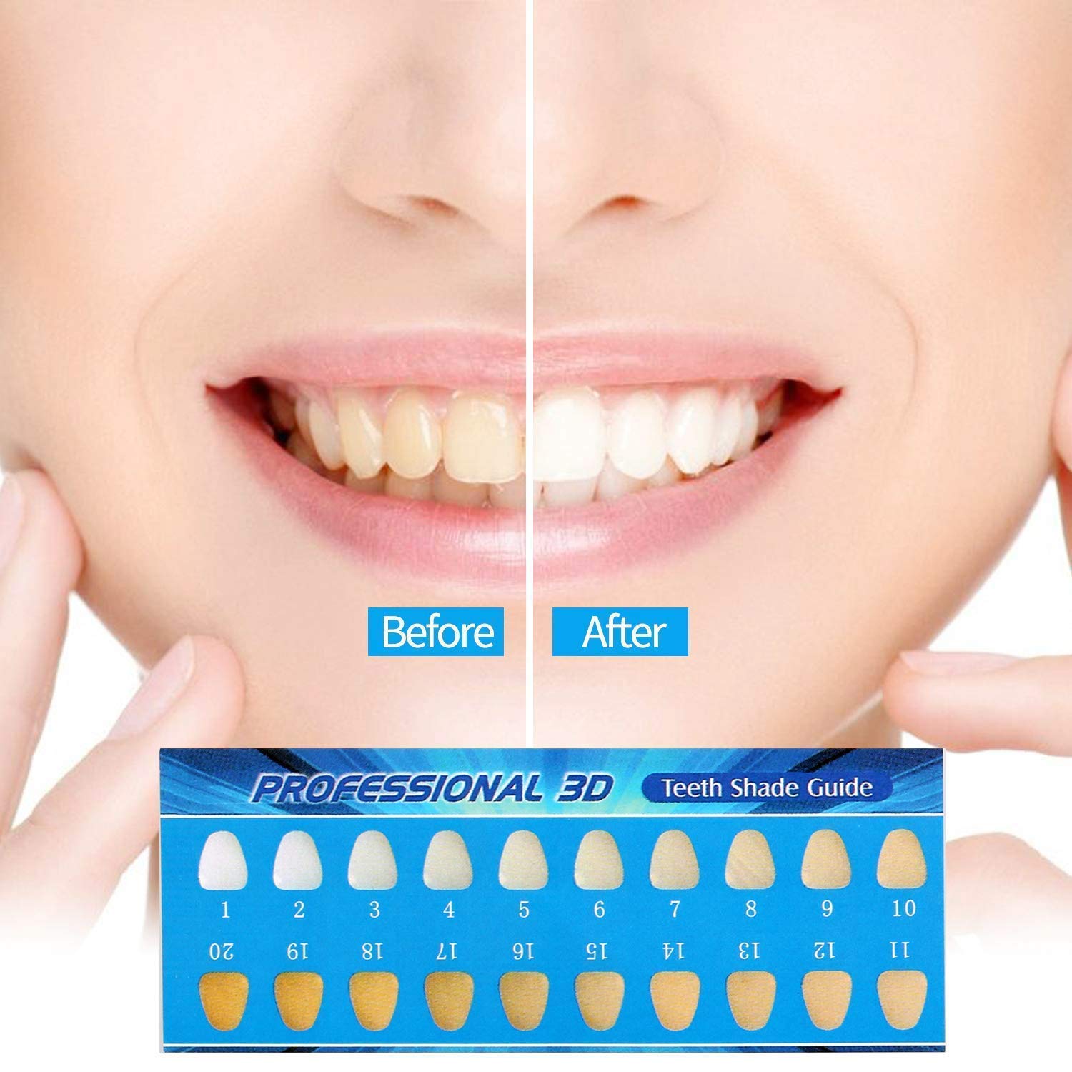 UNDOMIEL Teeth Whitening Kit Xpassion Professional Tooth Whiten Gel Dental Care Home Bleaching Kit for White Teeth Including 12 Teeth Whitening Gel