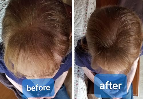 Caboki All-Natural Hair Building Make Thin Hair Look 10X