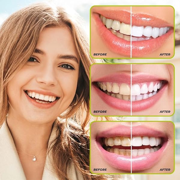 COCONUT OIL PULLING ALCOHOL FREE MOUTHWASH FOR FRESH BREATH, WHITE TEETH & HEALTHY TEETH & GUMS