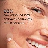 Peach Slices Dark Spot Microdarts 9 ct Niacinamide Vitamin C Hyaluronic view 6