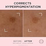 L'Oréal Paris Age Perfect Rapid Spot Corrector 50ml Niacinamide Peony Cells view 4