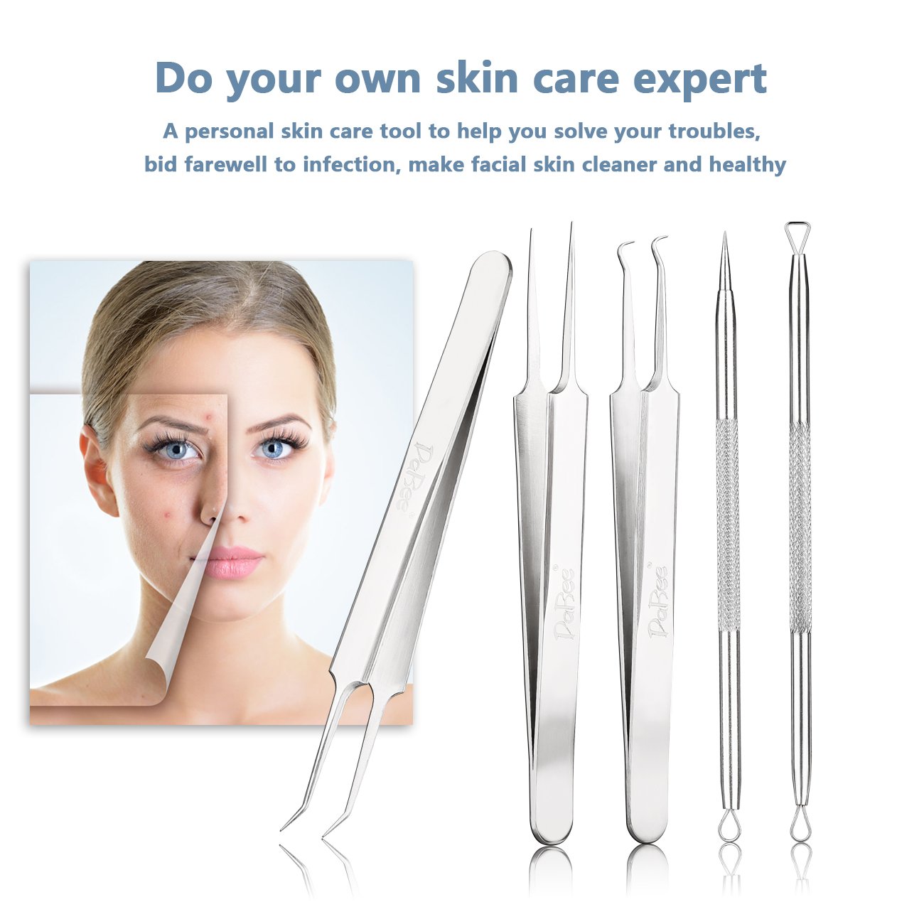 Professional Blackhead & Splinter Remover Tools Easily Cure Pimples Whiteheads Comedones Acne Zit Ingrown Hairs and Facial Impurities Surgical Stainless Steel with Alcohol Prep Pad