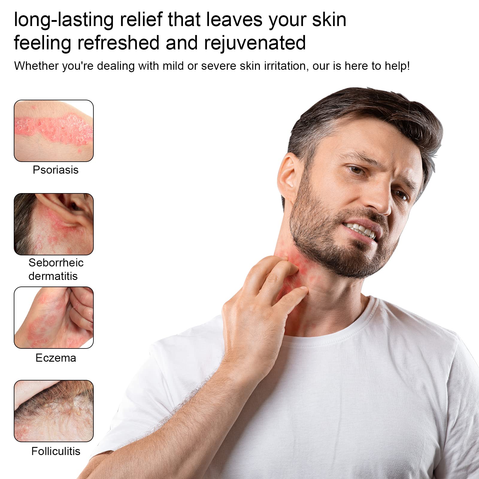 Draw Salve Eczema Cream Athlete's Itchy Foot Relief, Heat Rash, Anus Itch, Tinea Versicolor, Armpit, Lichen Planus, Cyst Removal Patch, Splinter Boil Ease, Ingrown Hair, Chigger, Carbuncle, Pilonidal