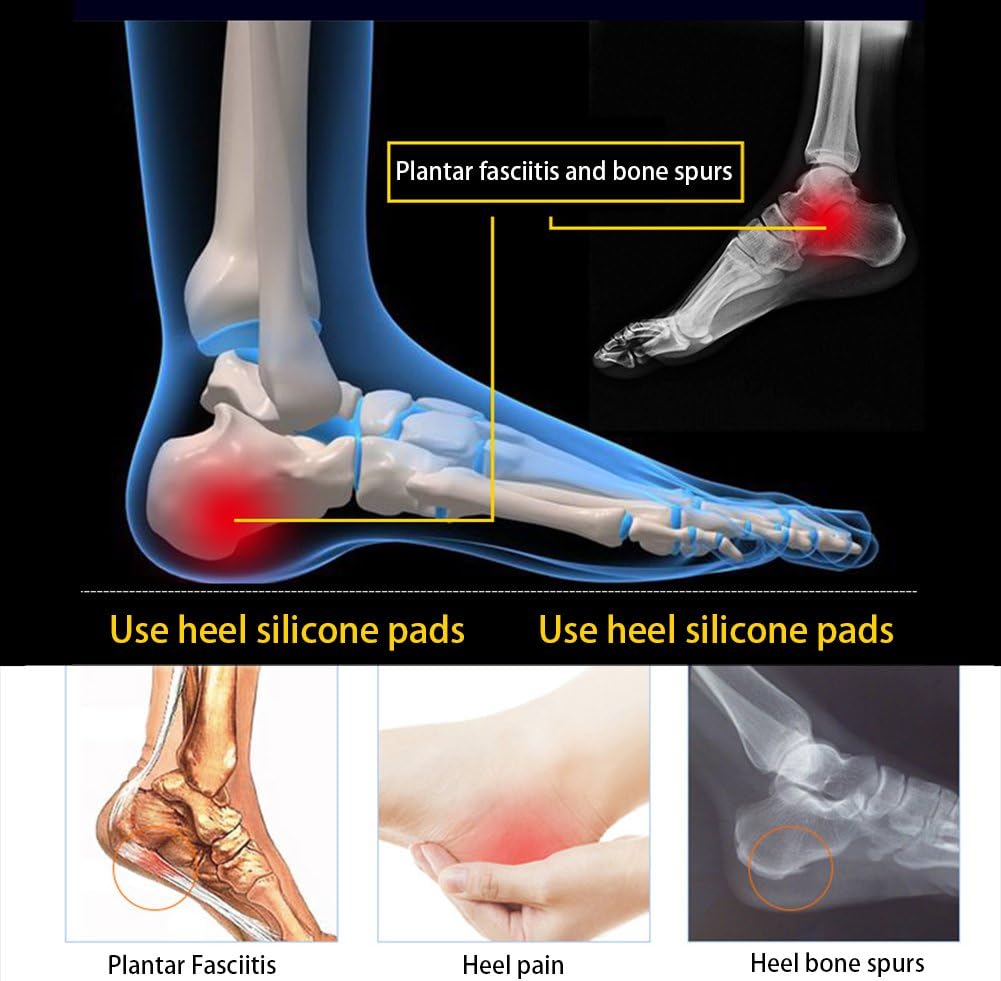 4 Pairs Heel Cups Plantar Fasciitis Inserts Pads, Gel Heel Protectors for Heel Pain, Silicone Heel Cushion and Cups, Pad for Plantar Fasciitis for Women & Men: Health & Personal Care