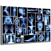 KLVOS Large Abstract Skull Canvas Art Wall Decor Black and Blue Collection Xray Multiple Part of Human Organs Gallery Wrap Canvas Prints Home Decor Giclee Print for Hospital Office Ready to Hang