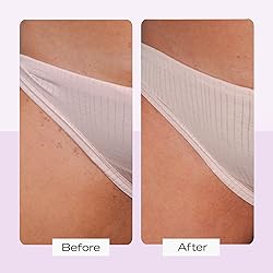 First Aid Beauty - Ingrown Hair Pads with BHA + AHA