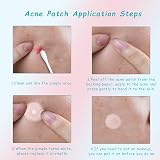 Azonelife 144 Hydrocolloid Acne Patches Face Spots Pimple Treatment Stickers view 3