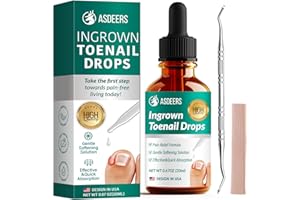 Ingrown Toenail Treatment: Ingrown Toenail Removal Kit - Nail Toe Reliever and Softener Tools for Men Women - Corrector Drops