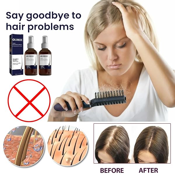 QUAAM 2PCS OUHOE HAIR GROWTH SPRAY, BROWN, UNISEX-ADULTS