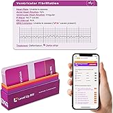 EKG Interpretation Flash Cards – for Nursing/EMT/Paramedic School – 2026 NCLEX ATI HESI Review LPN RN Flash Cards (45 Cards)