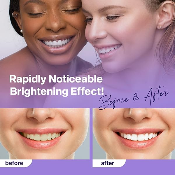 PURPLE WHITENING TOOTHPASTE FOR ADULTS – TEETH WHITENING, 30ML