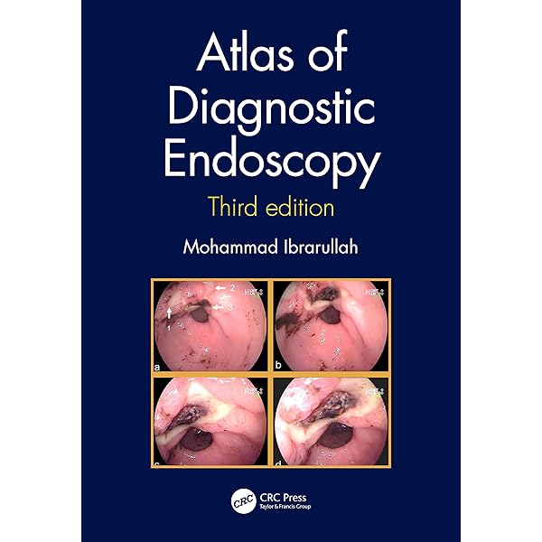 【医学専門書】Atlas of Urologic Endoscopy Atlas of Diagnostic Endoscopy, 3E: 9781032084381: Medicine