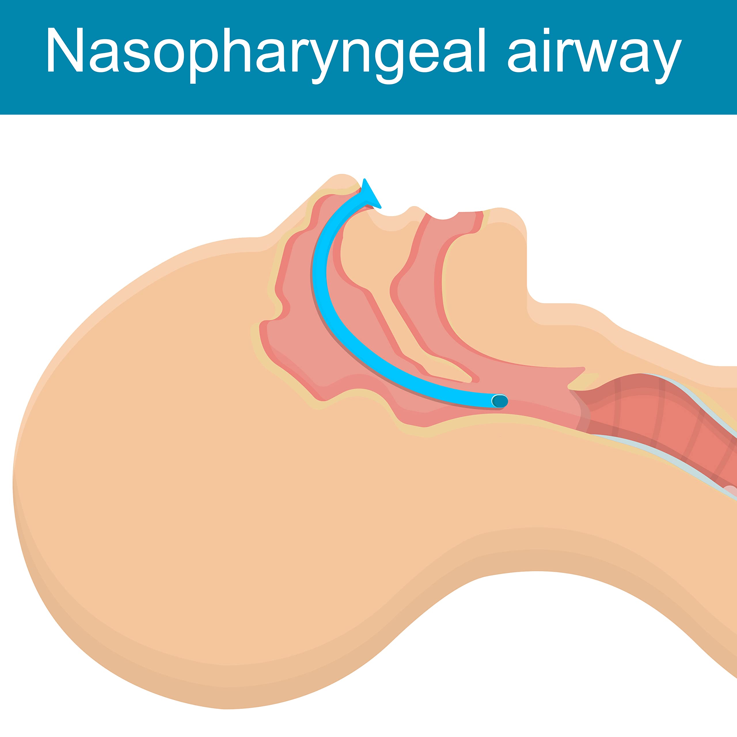 ASA TECHMED Nasopharyngeal Airway Emergency Kit 5X 7mm Individually Packaged Nasal Valves with 5 Packs of Lubricating Jelly - EMS Essential for Nasal Passage Opener