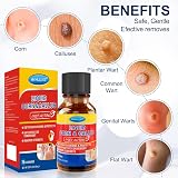 MYMULIKE Liquid for Corn Removers Extra Strength Foot Pain Relief 15ML view 3