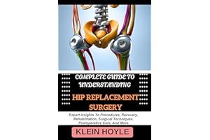 COMPLETE GUIDE TO UNDERSTANDING HIP REPLACEMENT SURGERY: Expert Insights To Procedures, Recovery, Rehabilitation, Surgical Te
