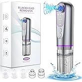 Blackhead Remover Vacuum with Microbubble Cleaning, Facial Pore Extractor & Pro Cleanser Tool, 3 Suction Levels, 5 Replaceable Heads for Deep Cleansing & Skin Care