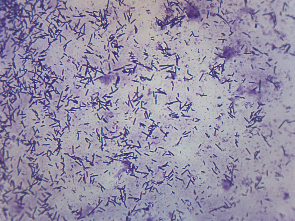 Escherichia Coli Smear Gram Stain Prepared Microscope Slide 75 X 25mm Biology Microscopy Eisco Labs Amazon Co Uk Business Industry Science Escherichia Coli Smear Gram Stain Prepared Microscope Slide 75 X 25mm Biology Microscopy Eisco Labs Amazon Co Uk Business Industry Science
