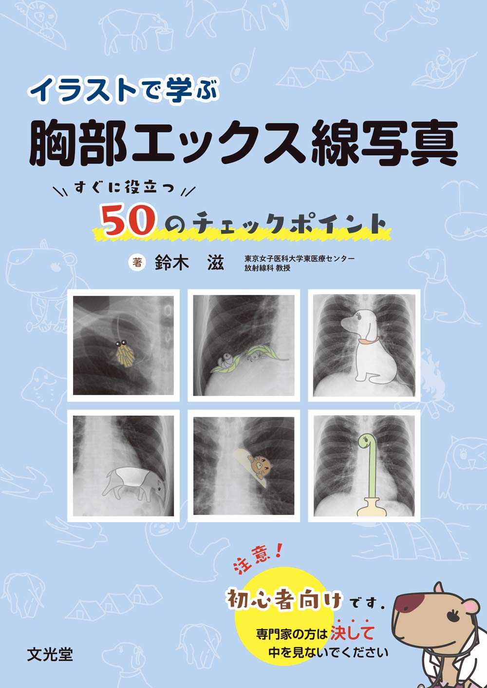 イラストで学ぶ胸部エックス線写真 鈴木 滋 本 通販 Amazon