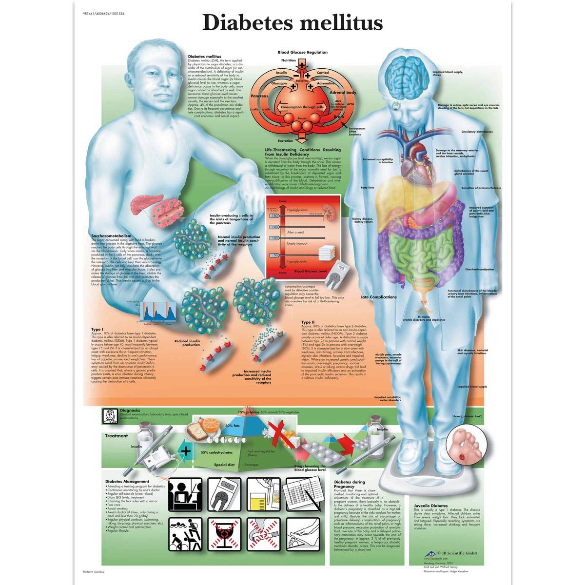 3B Scientific Human Anatomy - Diabetes Mellitus Chart, Paper Version