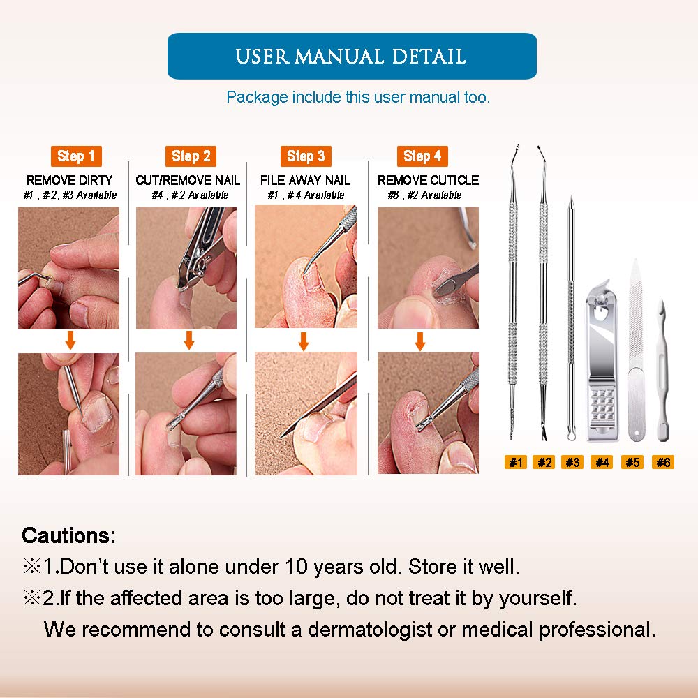 Premium 6PCS Ingrown Toenail Tools, Nail File and Lifter, Foot Nail Treatment Tool, Toe Nail Removal Clippers, Upgraded Stainless Steel, Professional Pedicure Tools, With Nail Cutter Trimmer: Beauty