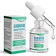 Fcoget Acne Spot Treatment Serum for Face, with 2% Salicylic Acid & 4% Niacinamide Face Serum, Liquid Pimple Patch for Acne Prone Skin, Soothing Redness, Clearing Oil Skin Care for Teens & Adults