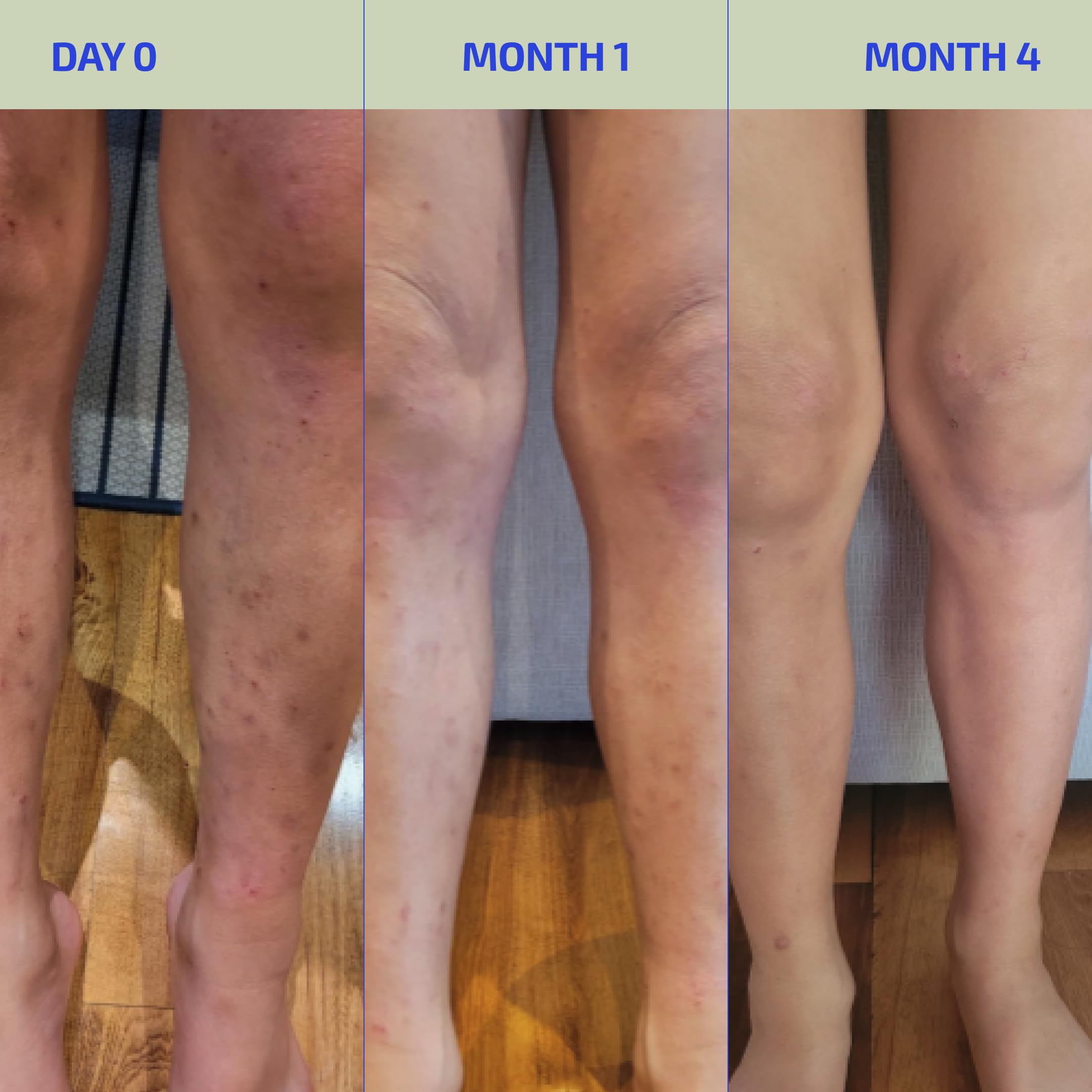 Codex Labs BIA Eczema Relief Lotion, 3.4 oz - Clinically Proven Colloidal Oatmeal 1% for Itchy Dry Eczema Prone Skin - Fragrance Free Moisturizer with BiaComplex 2.0 - Safe for Babies, Kids & Adults