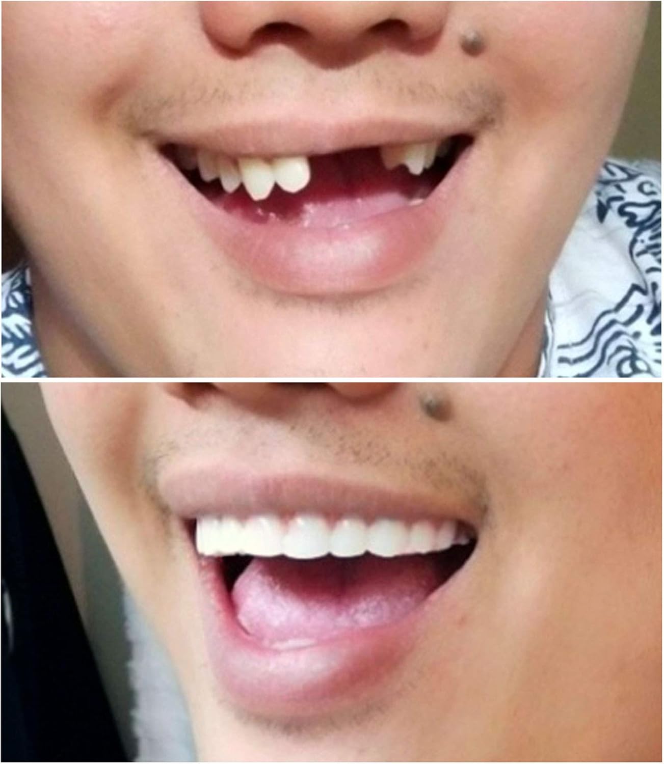 Instant Smile Comfort Fit Flex - Natural Shade - Upper Veneer Cosmetic Teeth: Toys & Games