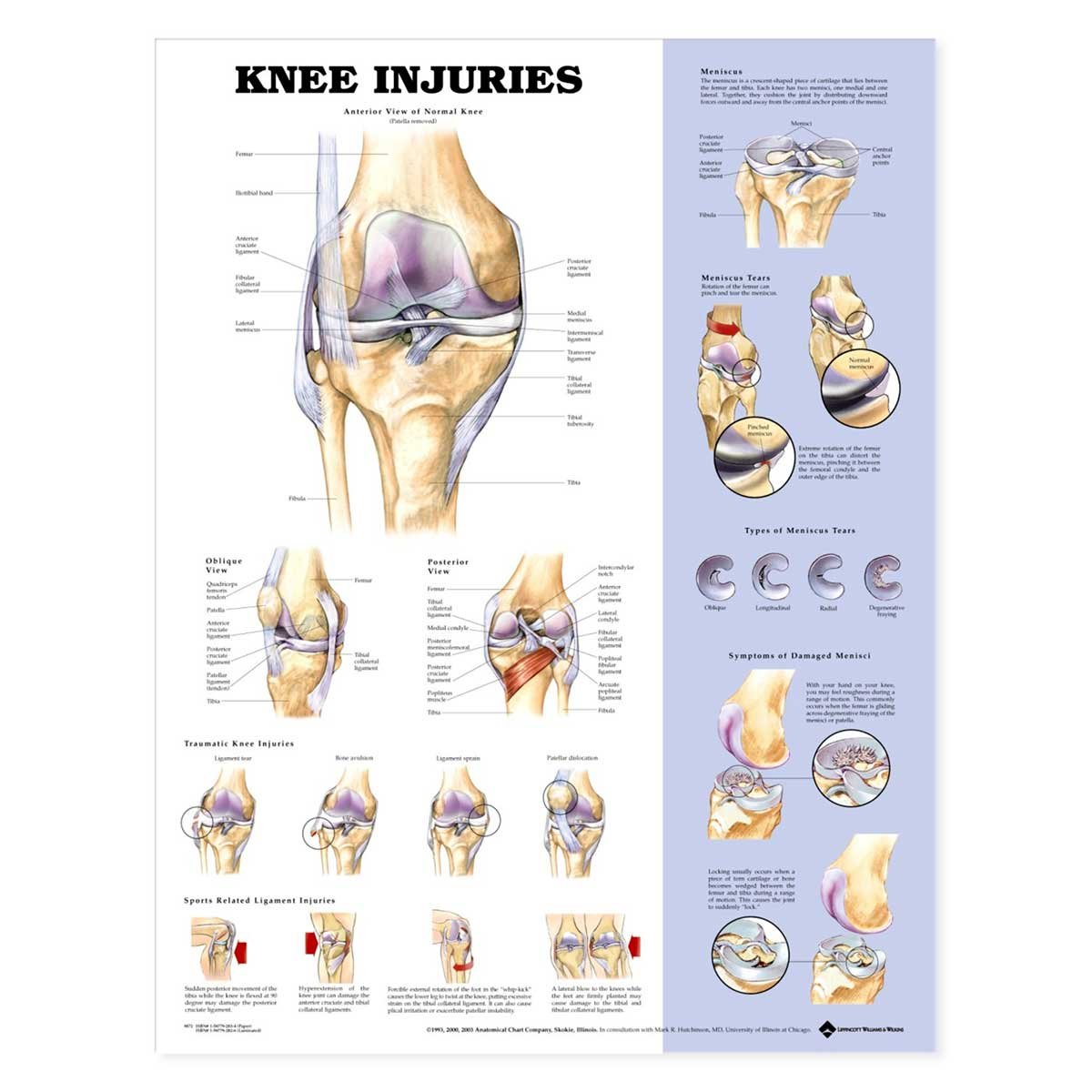 Knee Injuries Chart