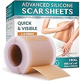 Silicone Scar Tape, Silicone Scar Sheets, Scar Tape for Surgical Scars, Silicone Tape for Scars, Scar Sheets for Surgical Scars, C-Section, Tummy Tuck and Keloid (1.6"x 60" Roll-1.5M)