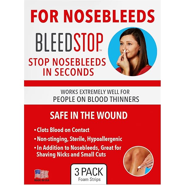 Nose Bleed Causes Treatment And More ubicaciondepersonas.cdmx.gob.mx