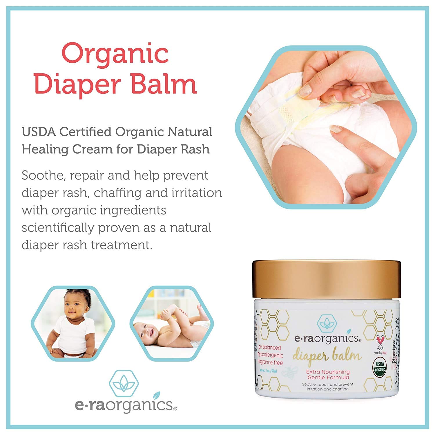 natural diaper rash treatment