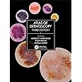 Atlas of Dermoscopy: Third Edition