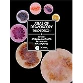 Atlas of Dermoscopy: Third Edition