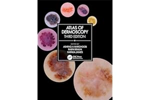 Atlas of Dermoscopy: Third Edition
