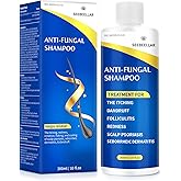 Seebeellar Psoriasis Shampoo Seborrheic Dermatitis AntiFungal anti dandruff Shampoo folliculitis flakes Scalp Treatment for men and women Relieves Scalp Itching 300ML