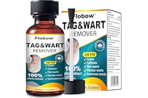 OJIOG Skin Tag Removal Kit - Fast-Acting Wart Liquid with 17% Salicylic Acid for Men and Women, Targets Plantar Warts, Flat Warts, Common Warts, Age Spots, Corns, and H-Warts (30ml)