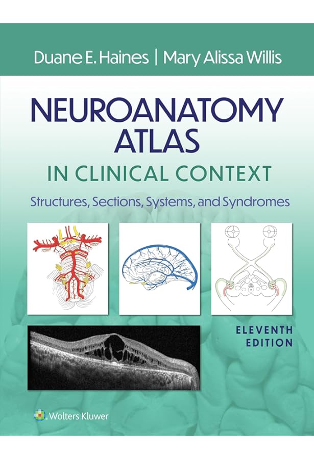 Decision Making in Neurovascular Disease: 9781684200573: Medicine