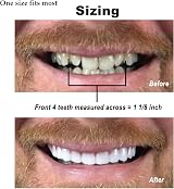 Instant Smile Comfort Fit Flex Cosmetic Upper Teeth Bright White Veneer view 9