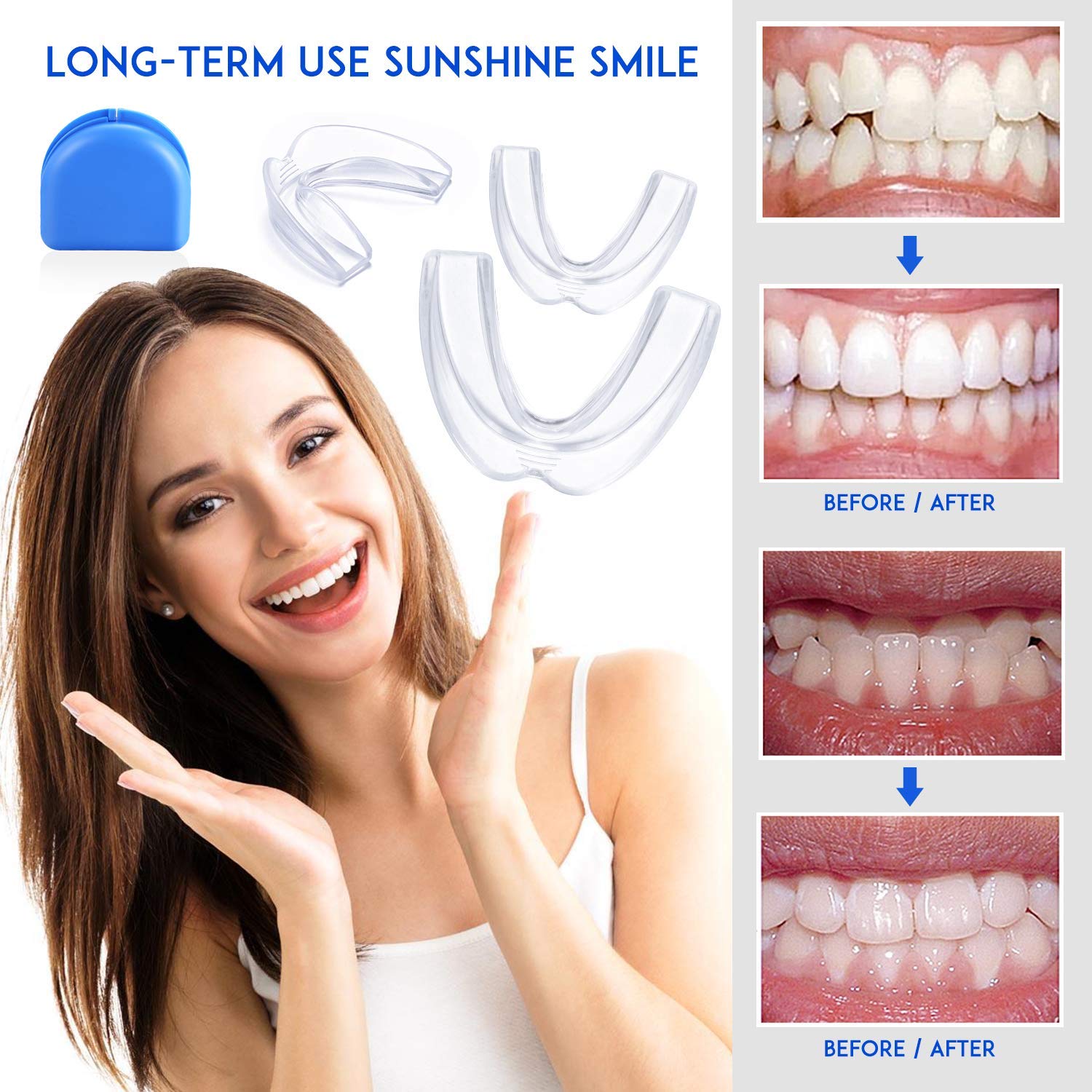 SGGI Mouthguard Teeth Grinding Mouth Guard Customizable and Trimmable Medical Grade Mouth guard for Grinding Teeth Clenching Bruxism Whitening Tray Sport Athletic Sleep Nightguard 2-Size 6 Pieces : Beauty