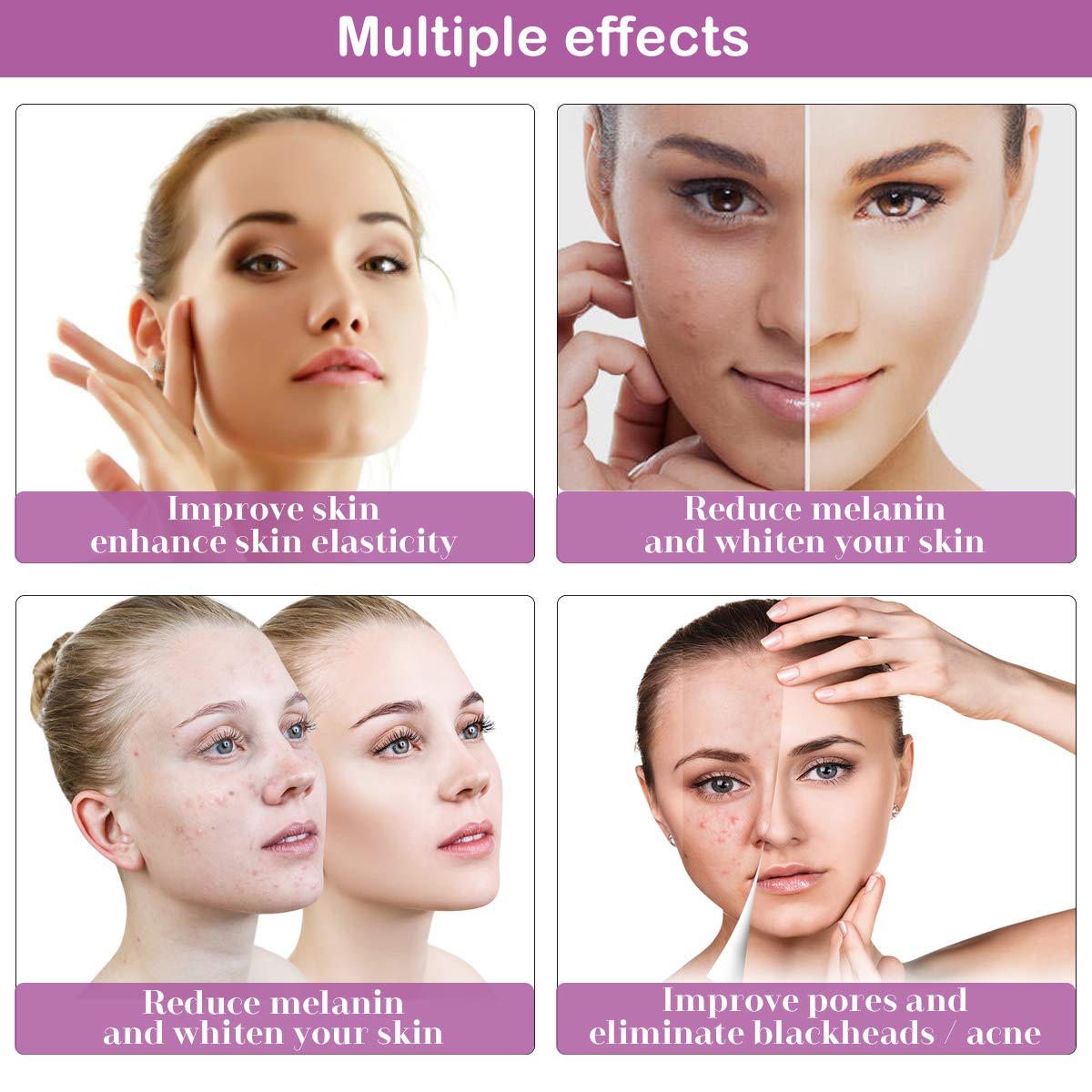 Diamond Microdermabrasion Machine, Yofuly 65-68cmhg Suction Power Professional Dermabrasion, Home Use Facial Skin Care Equipment: Beauty