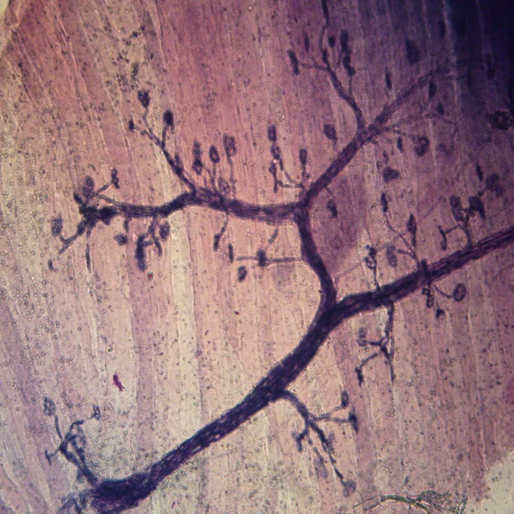 Mammal Motor Nerve Endings And Plates Teased Microscope Slide Microscope Sample Slides Amazon Com Industrial Scientific