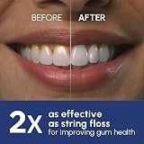 Waterpik WP-660UK Ultra Professional Water Flosser 5 Tips 10 Settings UK view 3