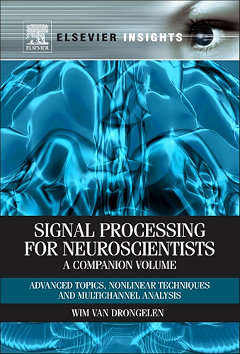 Download Signal Processing for Neuroscientists, A Companion Volume: Advanced Topics, Nonlinear Techniques and Multi-Channel Analysis (Elsevier Insights) (English Edition) PDF