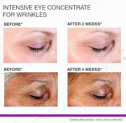 strivectin intensive eye cream