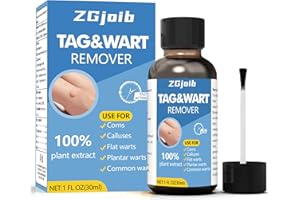 ZGjoib TAG Wart Remover Freeze Off Liquid with 17% Salicylic Acid – Fast-Acting Freeze Off Treatment for Common & Plantar Warts,Flat Wart, Corns – for Feet, Hands & Body (1oz) (NDC Code:84010-061-01)