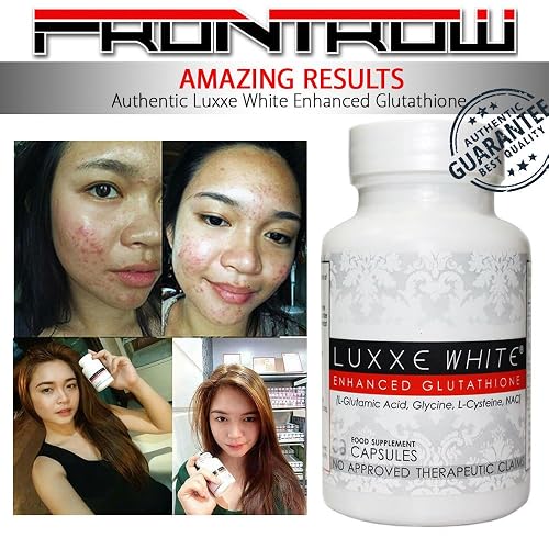 luxxe white enhanced glutathione price in dubai Cause that ULTIMA sparkle sure looks good with Prada or any other fashion brand #LuxxeWhiteUltima exclusively available through authorized # LuxxeWhite distributors Whitening Package Frontrow International