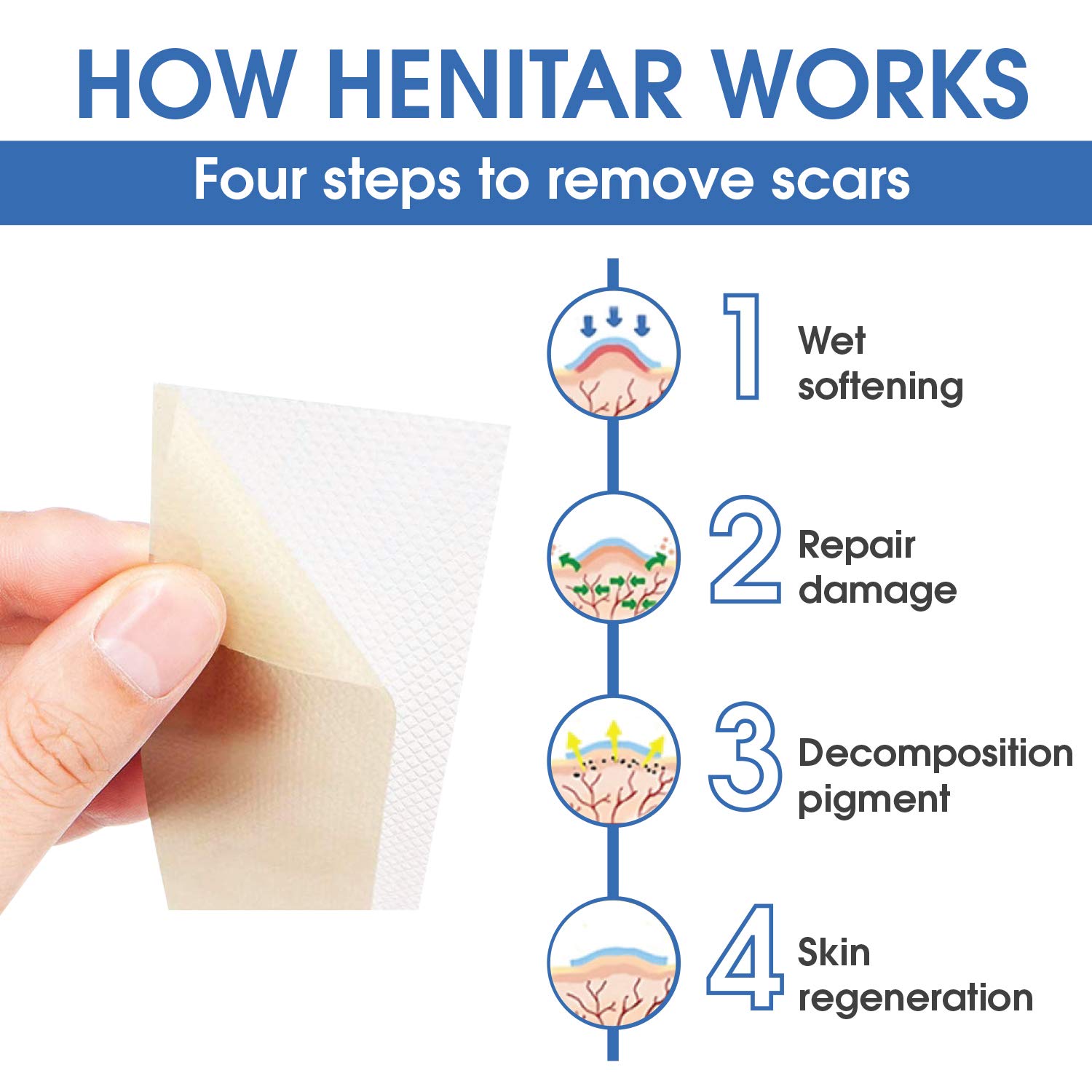 HENITAR Medical Silicone Scar Sheets, Soften and Flattens Scars, Ideal for Stretch Marks, Works on Old & New Scars, C-Section, Surgery, Burn, Injuries, Acne, and more scars, 5.7"×1.57” : Beauty