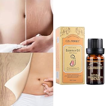 Ursing Stretch Marks Essential Oil Pregnancy Repair Grain Casual Line Belly 10mlschwangerschaftsstreifen Stretch Marks Scar Treatment Perineal Massage And Partner Massage Brown Amazon De Beauty