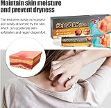 ChengJin Bed Sore Cream - Pressure Sore Relief & Cold Sore Treatment view 7