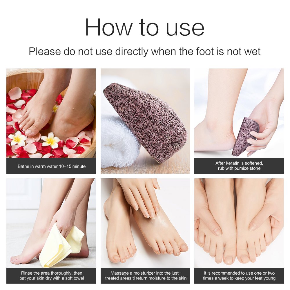 2 Pack Drops Shape Pumice Stone, Horsky Earth Lava SPA Soft Healthy Foot Callus Remover for Dry Hard Dead Skin Cracked Heel in Feet and Hands Skin Exfoliator Scrubber